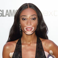 Height of Winnie Harlow